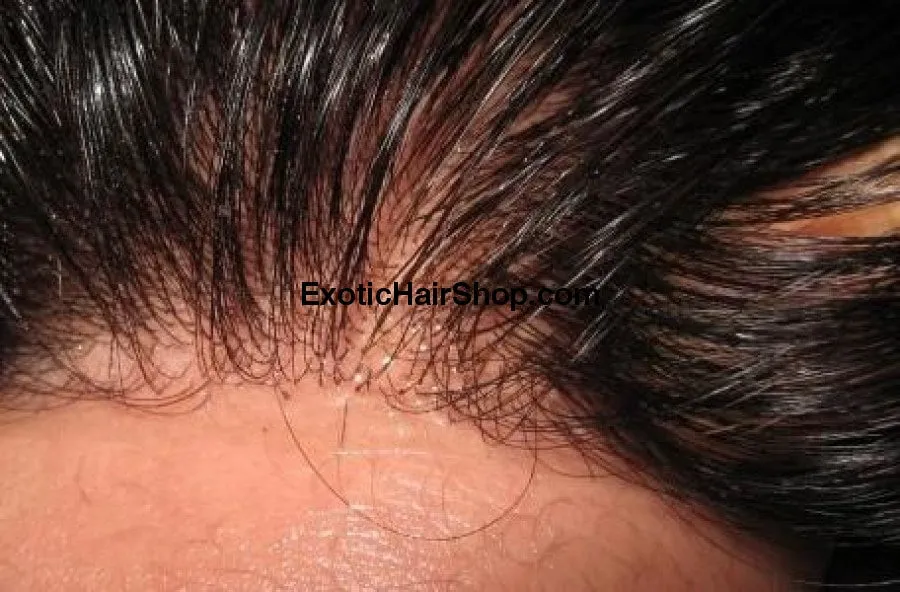 HD Thin Lace Closure - 7x7